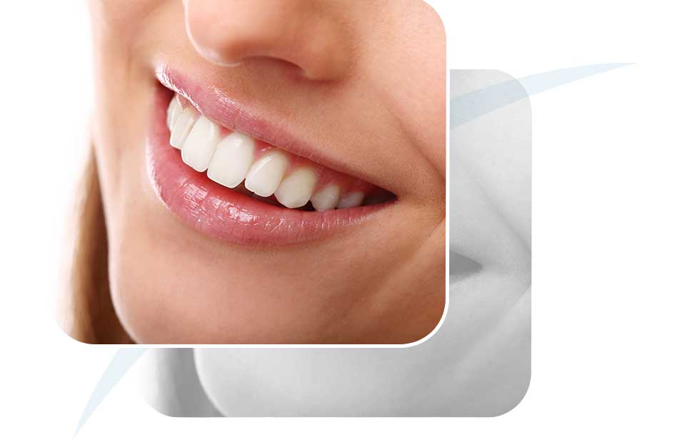 Cosmetic Dentistry | North Main Family Dental | Family and General Dentist | Airdrie