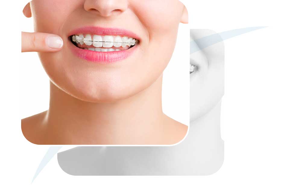 Dental Braces | North Main Family Dental | Family and General Dentist | Airdrie