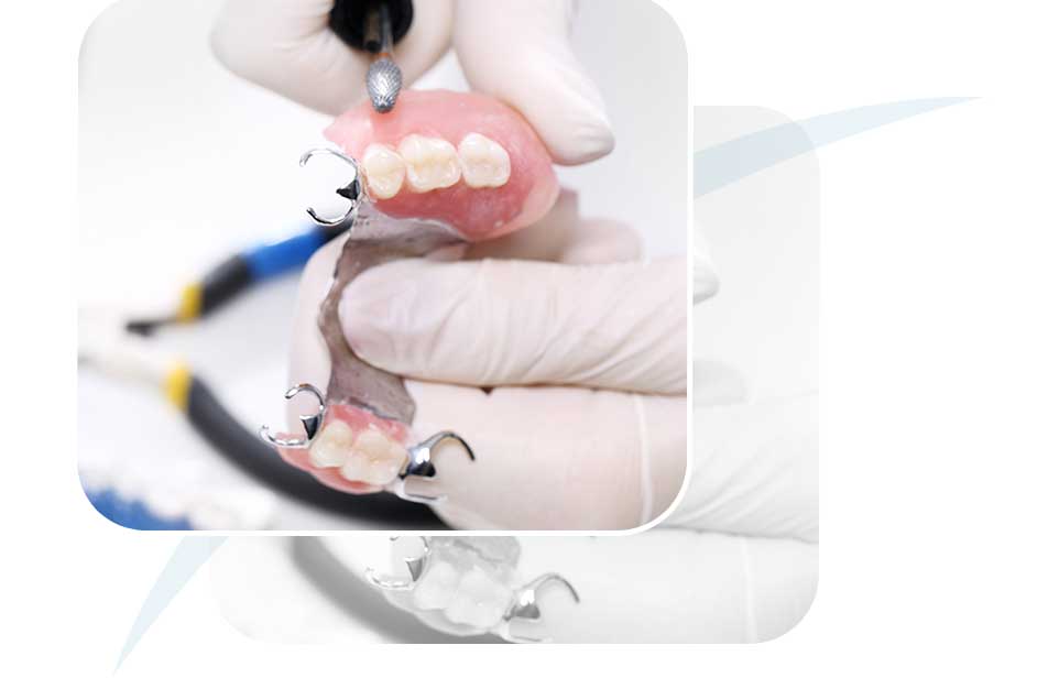 Partial Denture | North Main Family Dental | Family and General Dentist | Airdrie