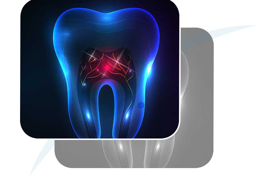 Root Canal Therapy | North Main Family Dental | Family and General Dentist | Airdrie