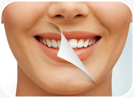 Teeth Whitening | North Main Family Dental | Family and General Dentist | Airdrie